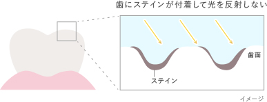 歯にステインが付着して光を反射しない